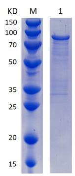 12% SDS-PAGE analysis profiles of purified MCR_RS02295-24-759 (CBB stained).